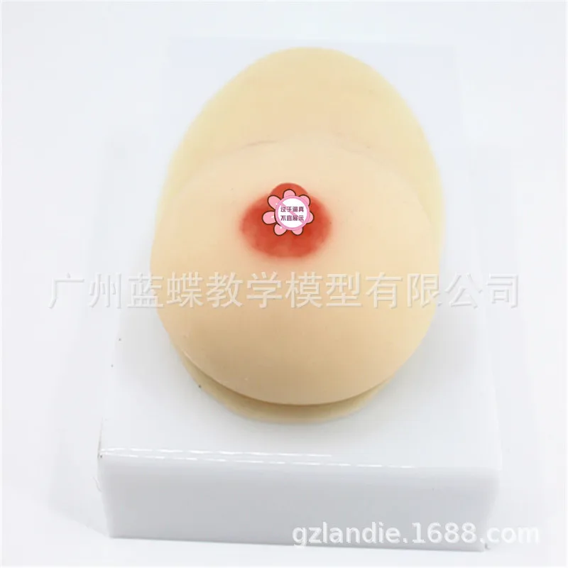 

Lactation Unilateral Silicone Breast Model Prolactin Division Ducational Training Equipment Prolactin Training Medical Teaching