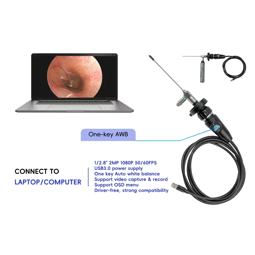 Telecamera per endoscopio USB potabile medica Full HD ad alta risoluzione per chirurgia endoscopica otorinolaringoiatrica connessione con Computer