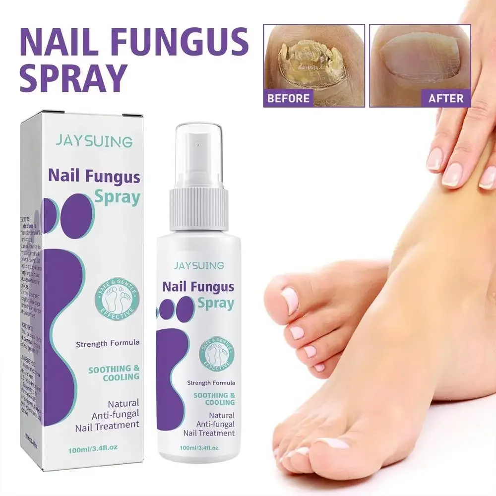 Herbal Toe Care Onychomycosis Spray, Mãos Nail Sweaty Foot Spray, Fortalecedor de unhas, Remover Odor Mist