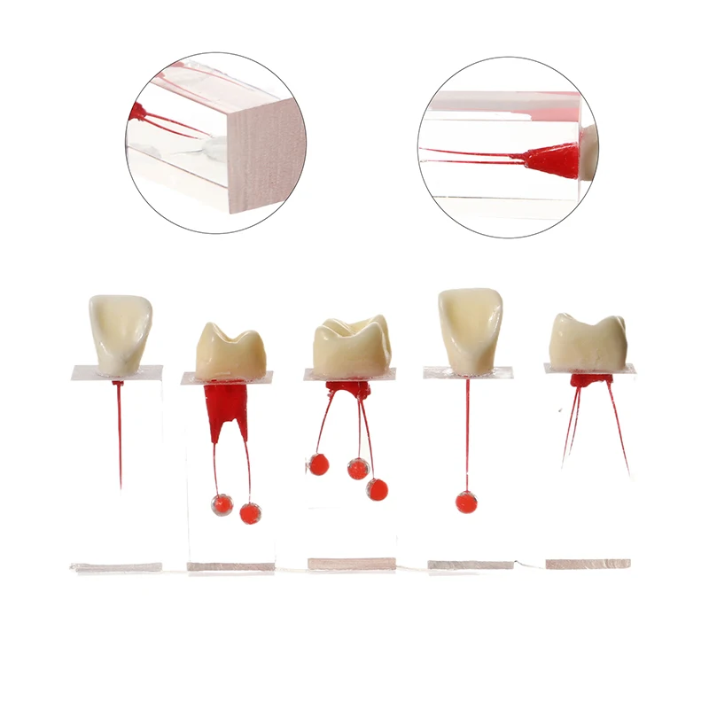 نموذج قناة جذور اللبية للأسنان ، دراسة تدريب طب الأسنان ، تعليم أسنان تجريبي ، راتنج أحمر وأبيض ، 1 التجريبي