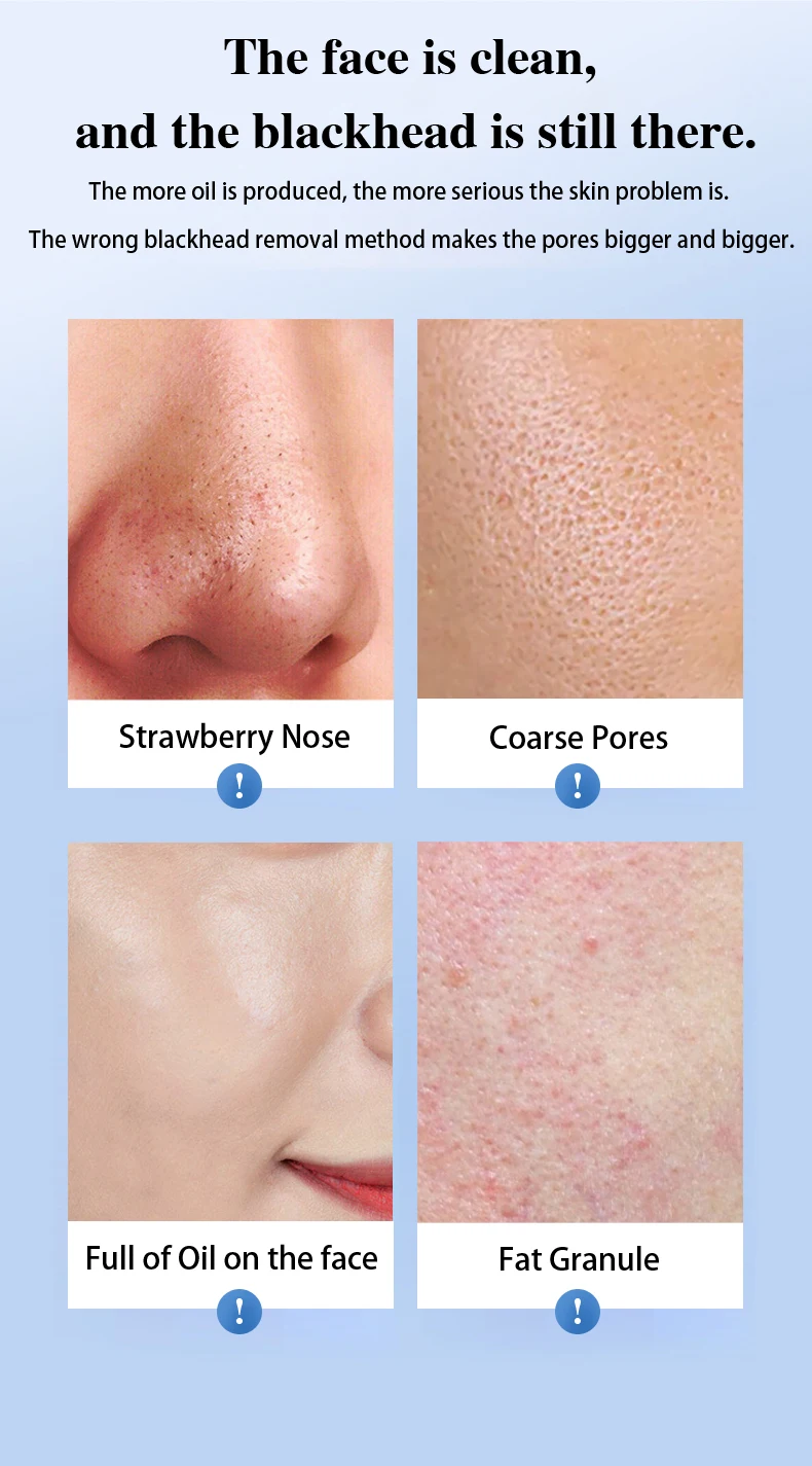 Biblioteca intelligente Spina USB Strumento per la cura del viso Pulizia profonda Viso Bellezza Lifting Uomo Donna Detergente per pori Rimozione olio di punti neri Sc