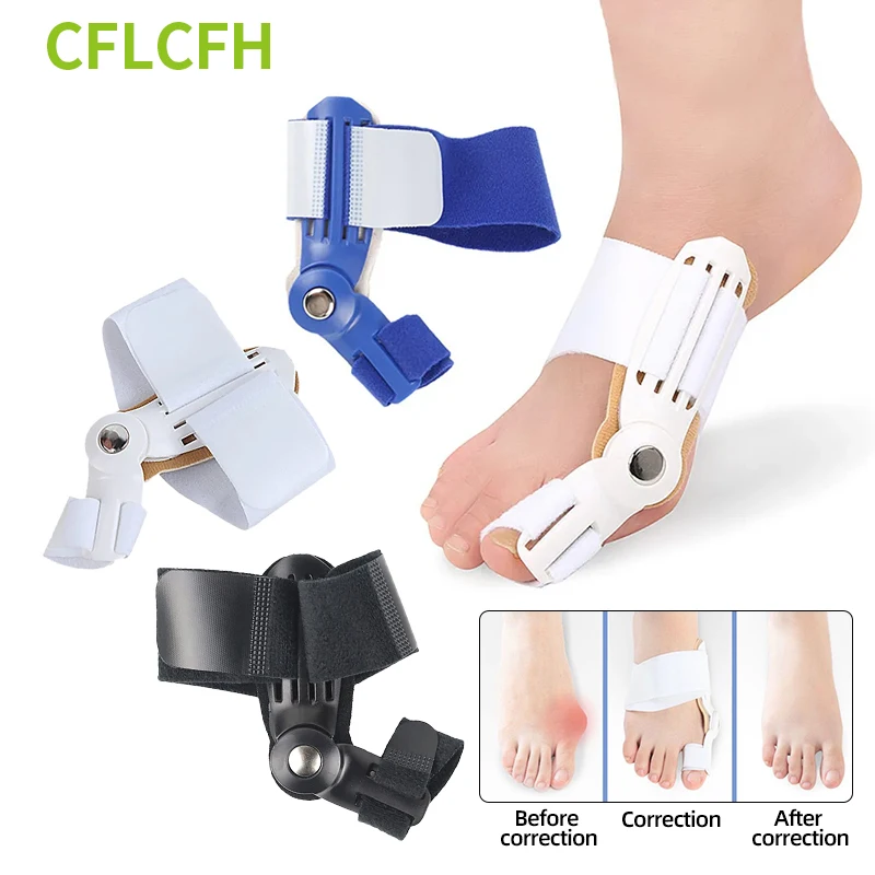 

Bunion Corrector Adjustable Hallux Valgus Separator Big Toe Straightener Bunion Splint Bone Correction Pedicure Unisex Foot Care