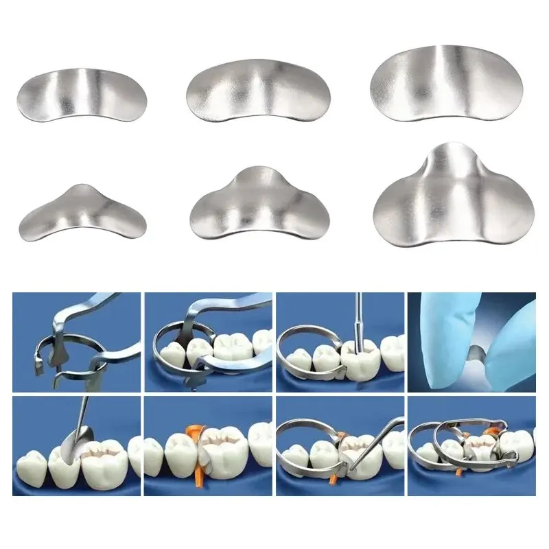 100Pcs/Box Dental Sectional Matrix System Band Resin Clamping/Seperating Ring Dentist Tools with Springclip Care Tool - view 3