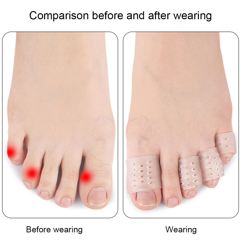 2 Pcs Toe Protector Transparent Silicone Toe Sleeves Breathable Toe Tubes for Bunion Corns Hammer Toe Blisters Calluses