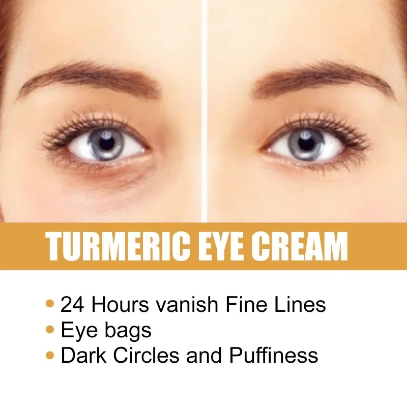 

Sdatter Turmeric eye cream fade fine lines dark circles remove Eye Bag wrinkle Anti Aging Firming moisturizing Whitening brighte