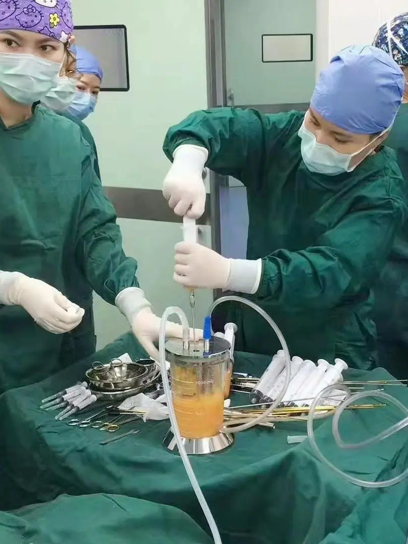 1500ml kanistry/słoiki przyssawki System wielokrotnego użytku do zbierania i separacji tłuszczu transplantacji tłuszczu — zdjęcie 2