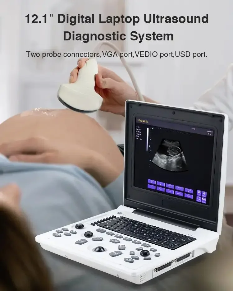 Digital Echocardiography Instruments Sonography Ultrasonography Laptop Black And White Portable Medical Ultrasound Scanner USG