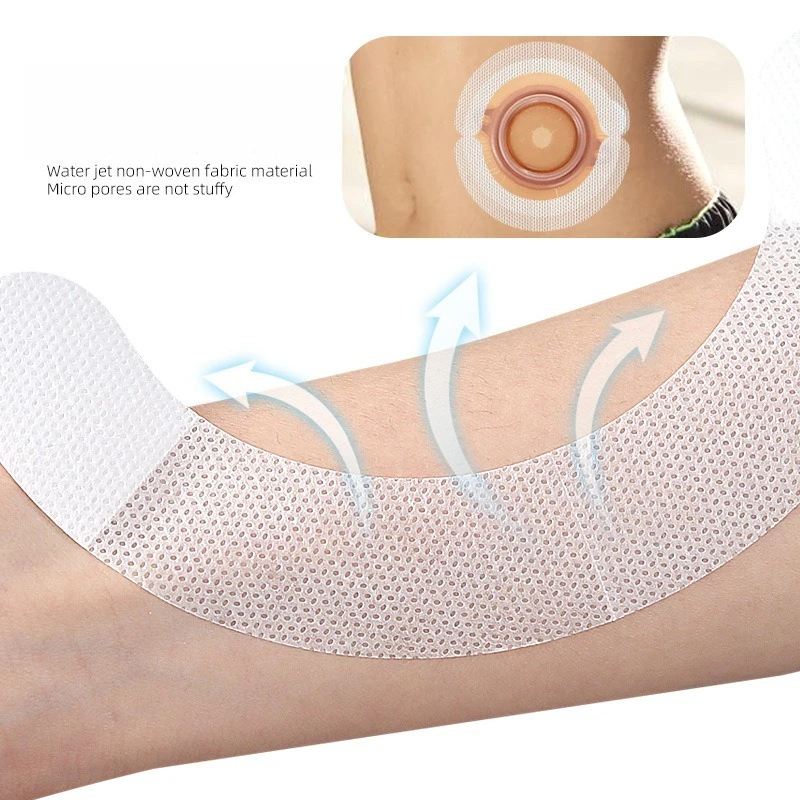 Stoma Care Leak-Proof Adhesive Hydrophilic Nonwoven Fabric Reinforcement Strip Y-Shaped C-Shaped Ostomy Bag Baseplate Adhesive