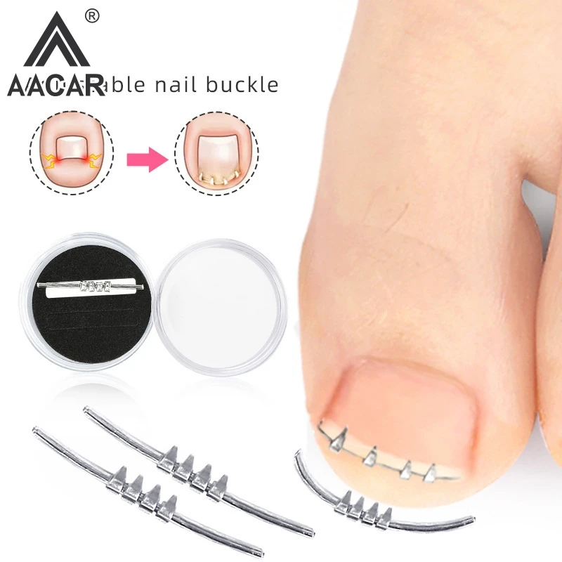 1PCS Ingrown Toenail Correction Tool Invisible Ingrown Toe Nail Elastic Straightening Clip Brace Pedicure Tool