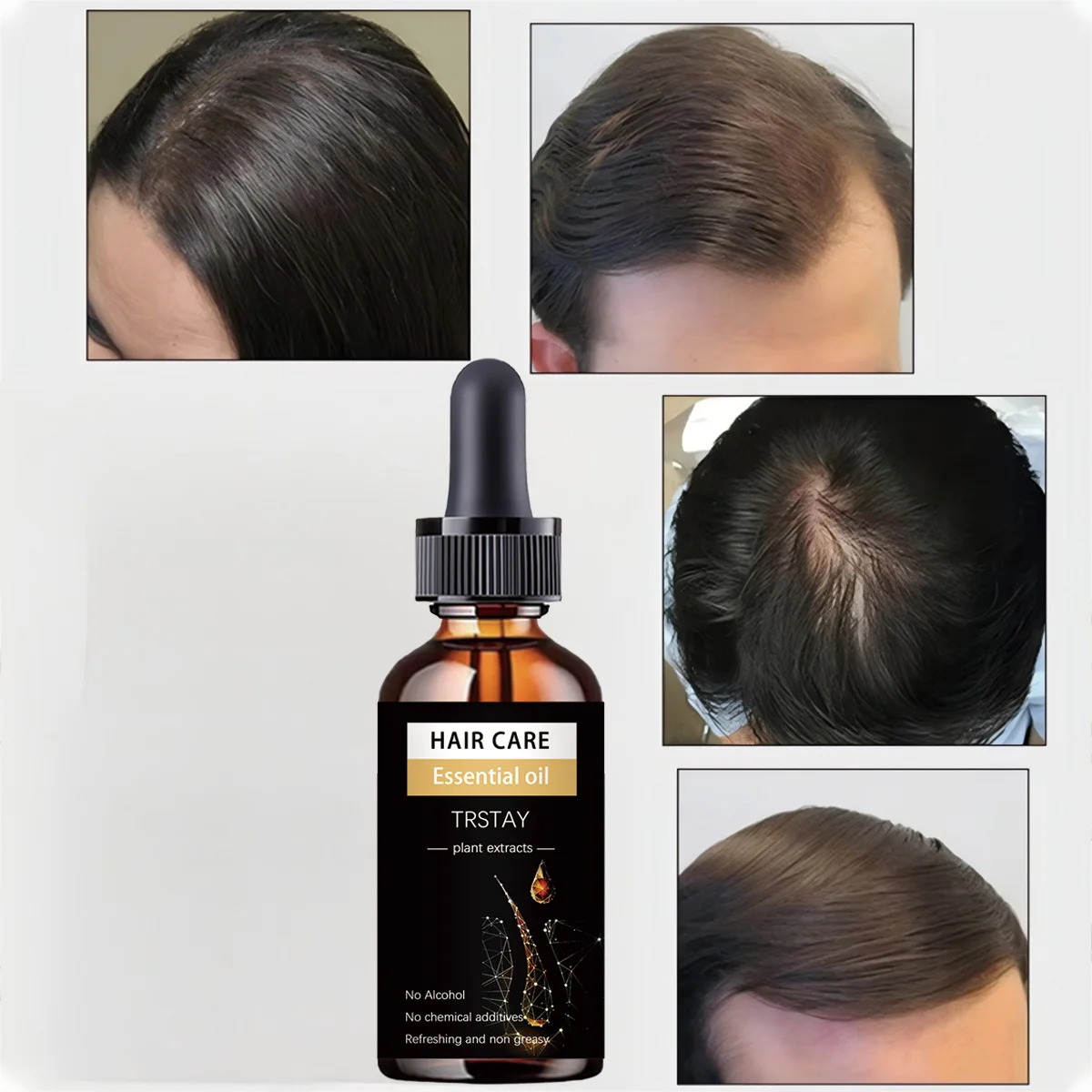 

Hair Growth Essential Oil Biotin Cold-Pressed DHT Blocker And Hair Growth Shampoo Anti-Hair Loss Conditioner Hair Accessories