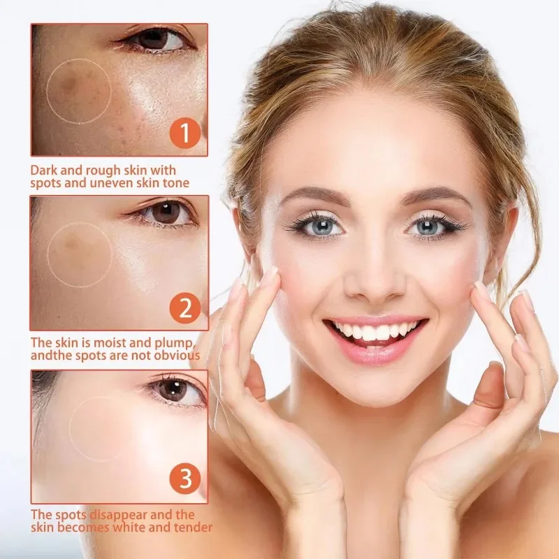 Effective Remove Melasma Serum Vitamin C Brightening Face Serum Korean Lighten Dull Skin Essence Women Fade Chloasma Facial Care