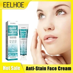 Eelhoe creme facial anti-manchas para manchas escuras do rosto produtos de brilho remoção de pigmentação clareamento melasma remover creme