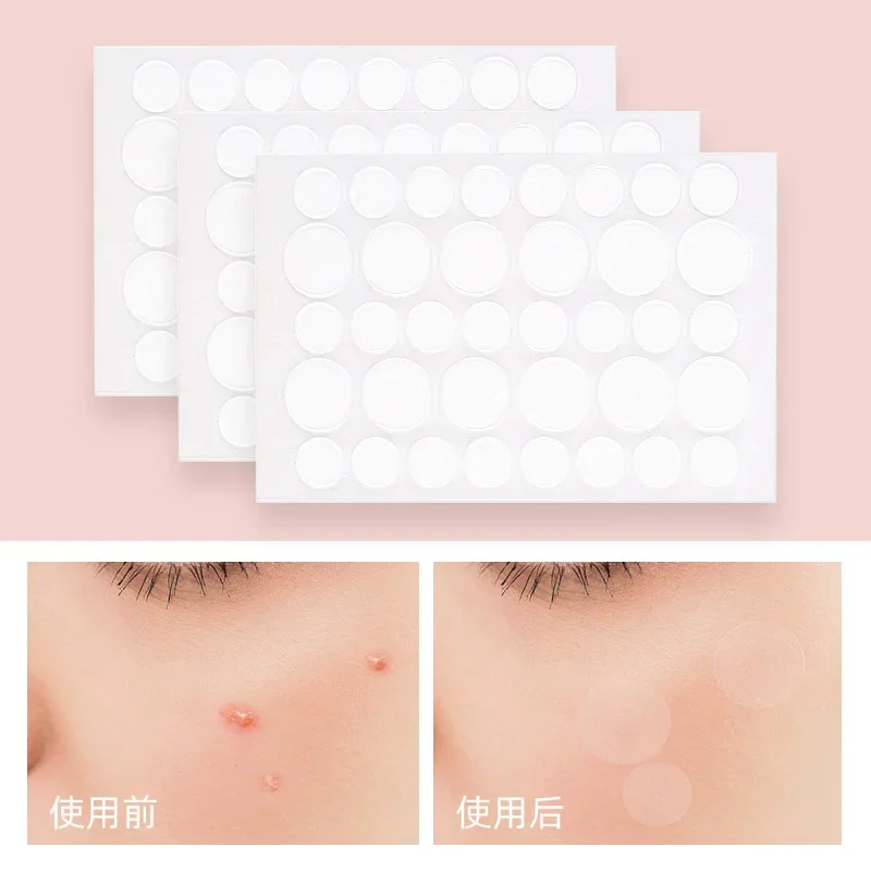 36Pcs Invisible Acne Patches Removal Pimple Anti-Acne Hydrocolloid Patch Spots Marks Concealer Repair Sticker Waterproof Lasting