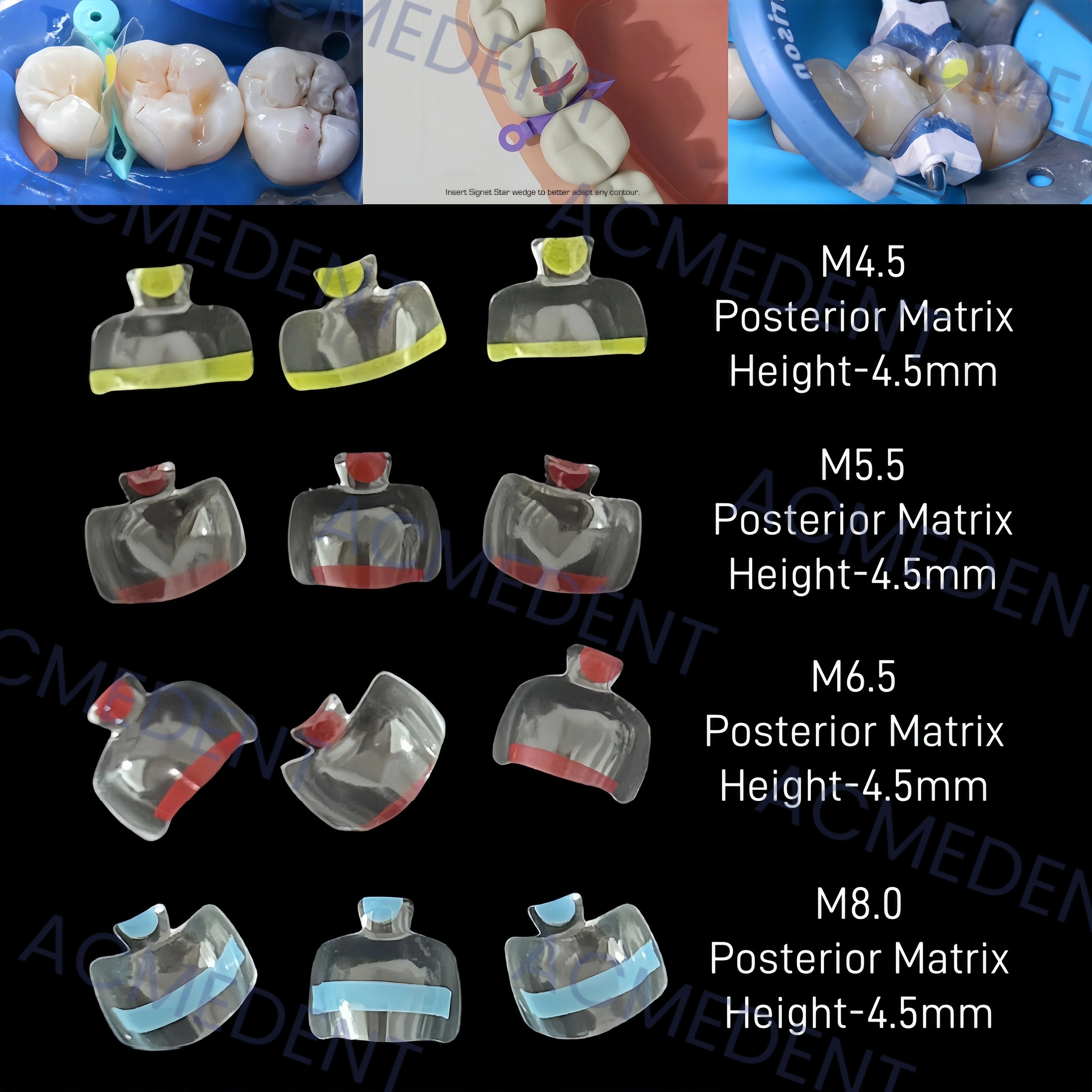 5 Stücke Dental Transparent Klar Matrix Anterior Hinten Restaurierung BT Bogen Matrizen Konturierte Fit BioClear Schwarz Dreieck