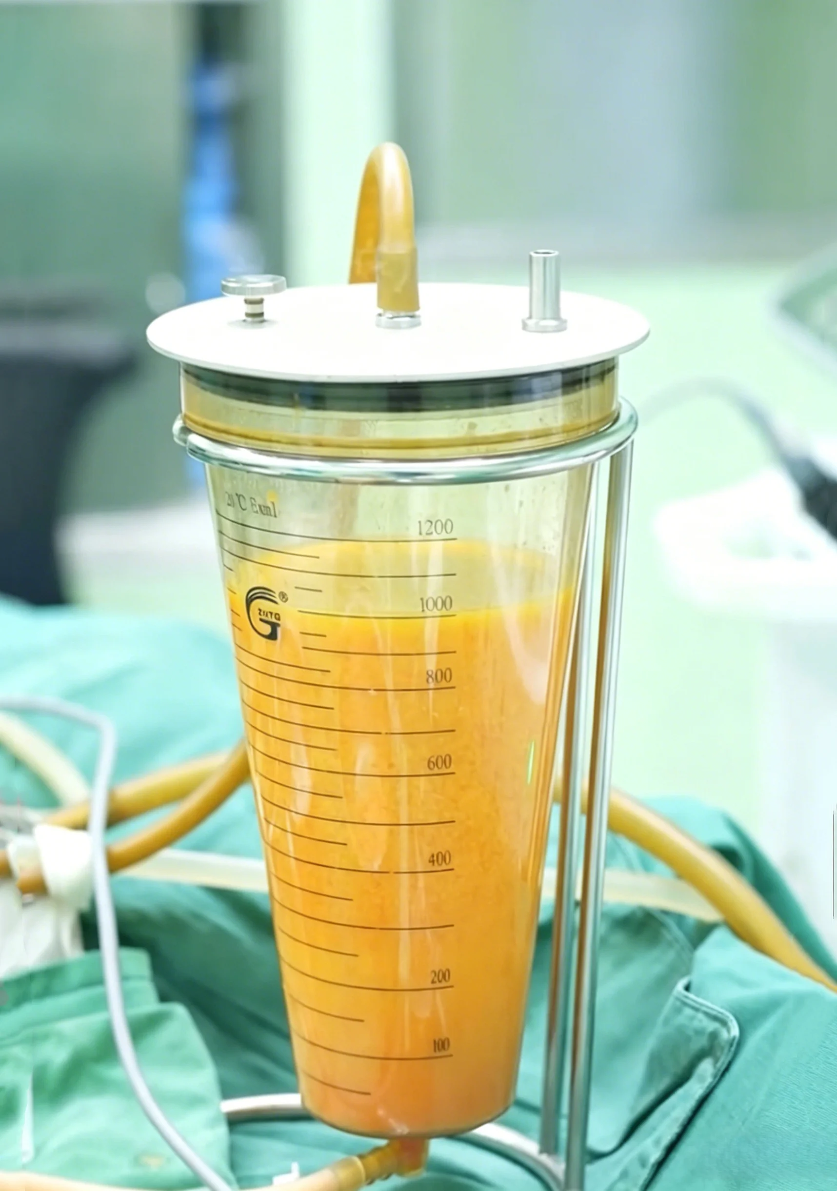 

1,200ml Fat Vacuum Collection Canister with Ring-mounted bracket Autoclavable