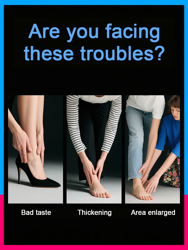 Not only can it gradually remove hard, ᵒˡᵈ ⁿᵃⁱˡ ᶠᵘⁿᵍⁱ⸴ ⁱᵗ ᶜᵃⁿ ᵃˡˢᵒ ⁱⁿʰⁱᵇⁱᵗ ᶠᵘⁿᵍᵃˡ ʳᵉˢⁱᵈ