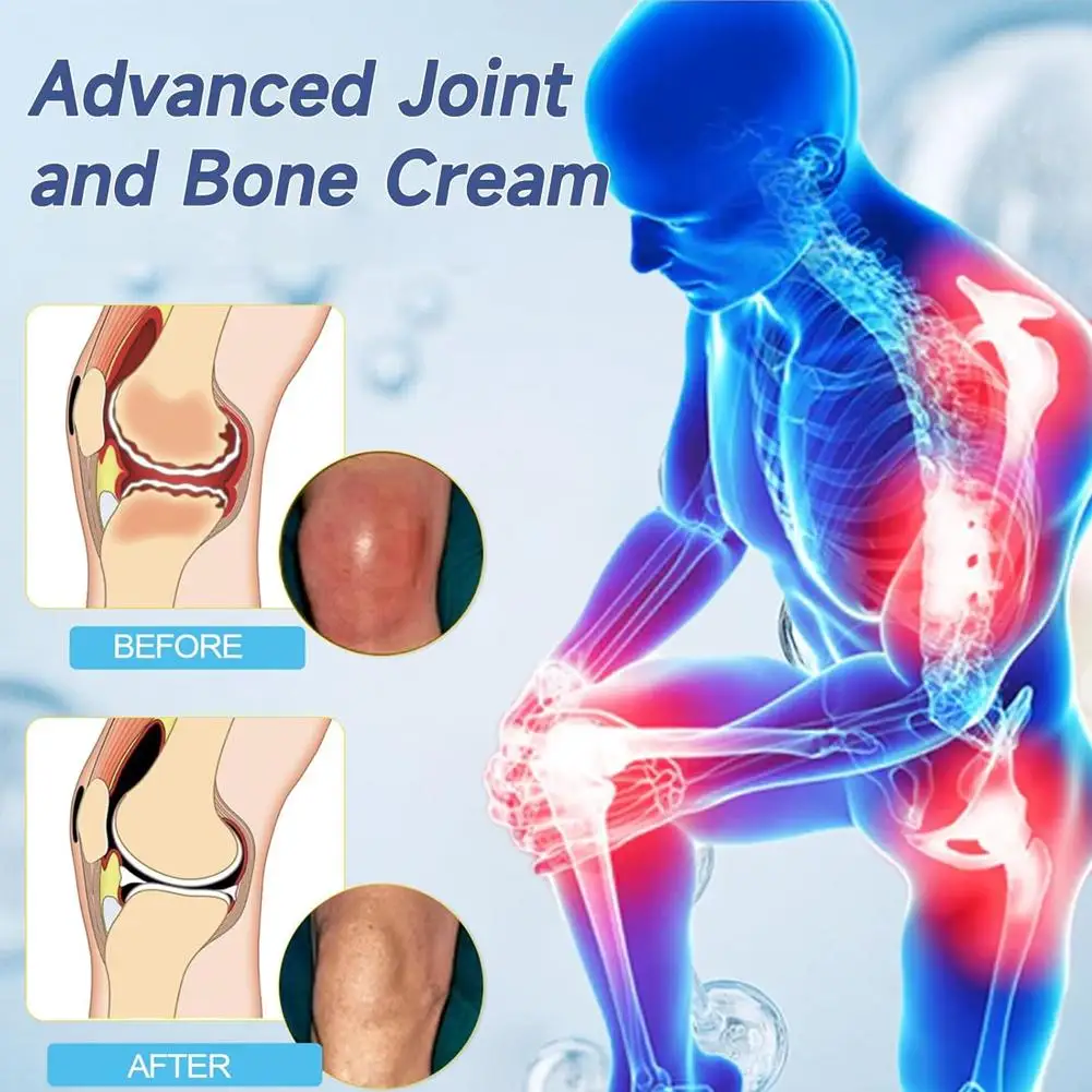 50g Joint Repair Cream Joint And Bone Care Cream Hyaluronic Acid Joint Cream Shoulder Pain Neck Pain Pain In The Wrist