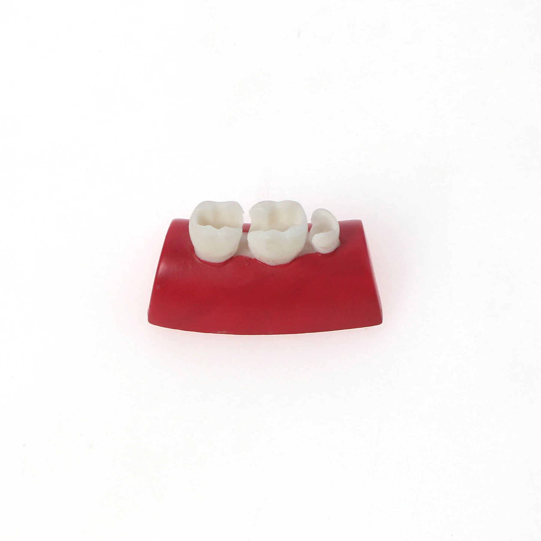 

Dental Model Filling Practice Typondont Precast Hole Inlay Exercise Model Block 8010