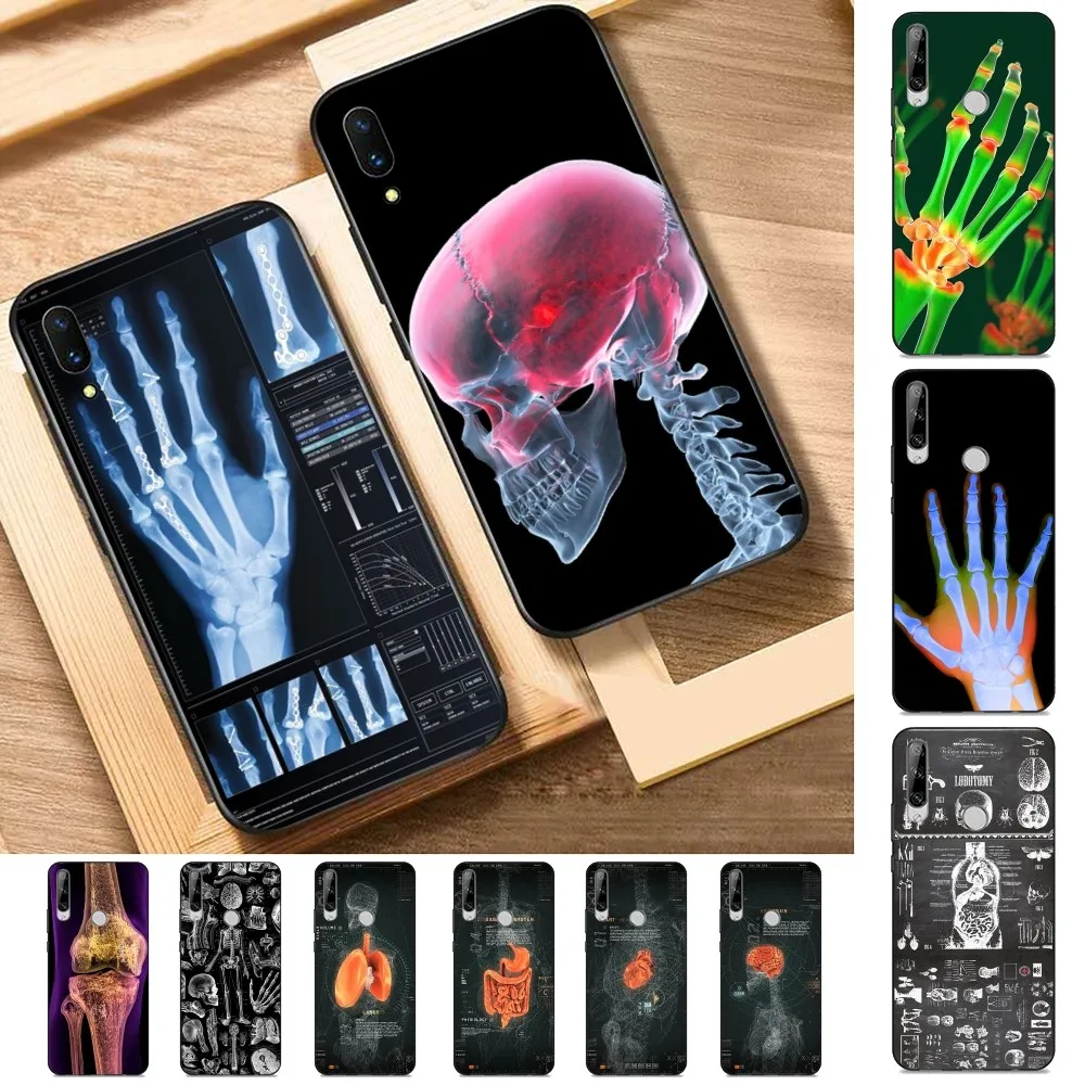 

Radiological human organs Skeleton Phone Case For Huawei Y9 6 7 5 Prime Enjoy 7s 7 8 plus 7a 9e 9plus 8E Lite Psmart Shell