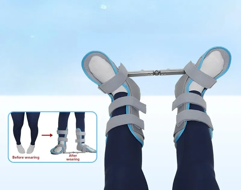 

Children's Internal Horoscope Orthotics, Medial Valgus Correction Belt Brace, Night External Horoscope