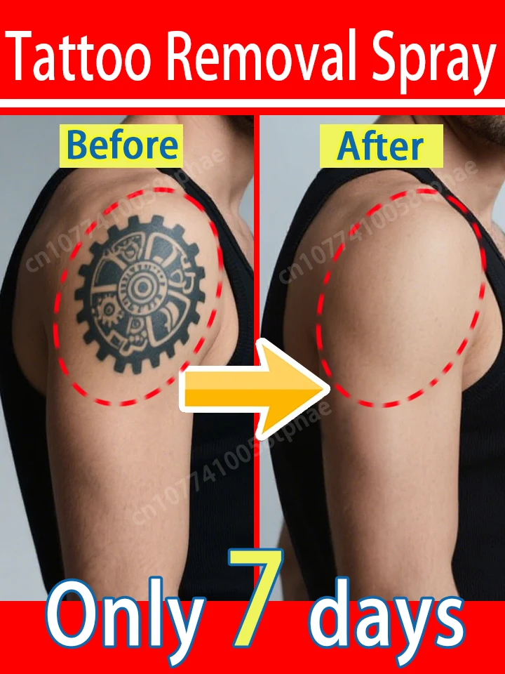 

Tᴀᴛᴛᴏᴏ Rᴇᴍᴏᴠᴀʟ Sᴘʀᴀʏ , Eᴀsʏ Tᴏ Usᴇ , Eɴᴏᴜɢʜ Fᴏʀ Aʟʟ Aɢᴇs Nᴏ Sᴄᴀʀs , Jᴜsᴛ Cʟᴇᴀɴ Sᴋɪɴ!!