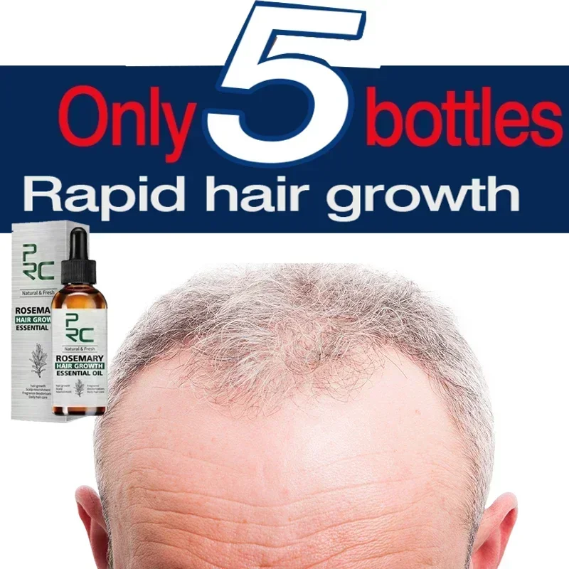 Fast Hair Growth Essential Oil Promoter AHair Loss Hereditary Seborrheic Alopecia Treatment for AHair Growth Essence Natural 090