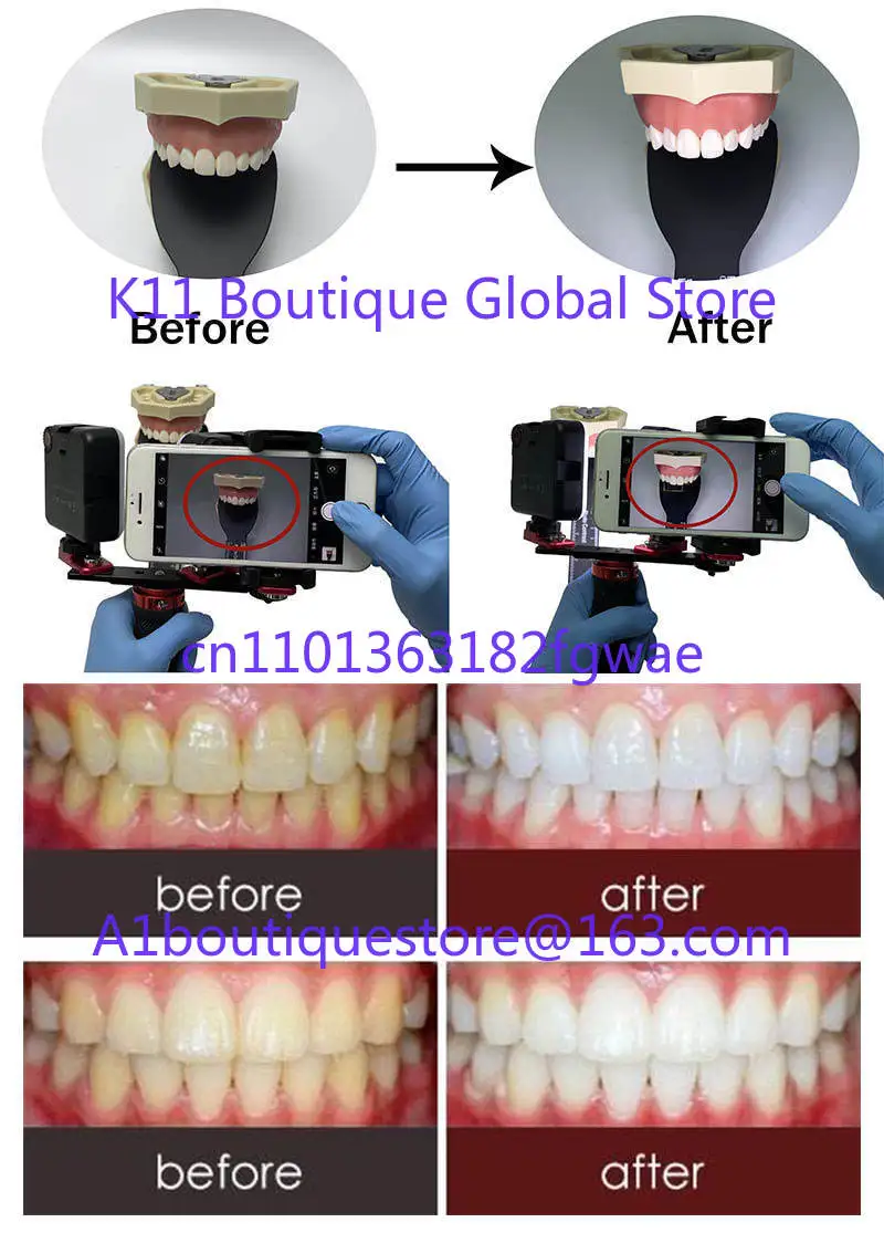 Bluetooth Fill Light Flash Dental Photography Equipment 64 90 Light Emitting Diode Beads Brightness Adjustment Dental Tools