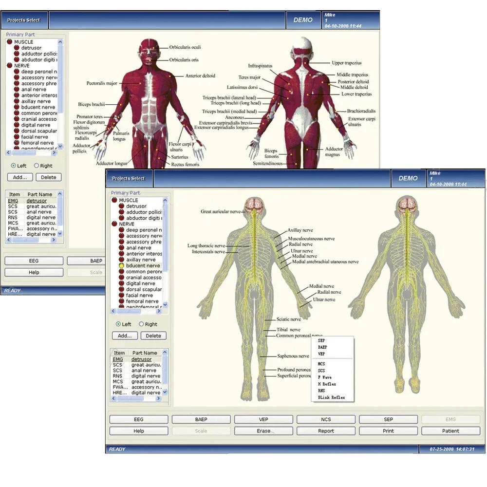 CMS6600B Macchina EMG portatile Monitoraggio Sistema EP Basato su PC Bioelettricità muscolare nervosa a 4 canali Elettromografo evocato