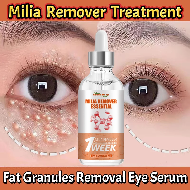 

Fat Granules Removal Eye Serum Eye Milia Repair Treatment Products Wrinkle Lifting Moisturizing Anti-Puffiness Korean Skin Care