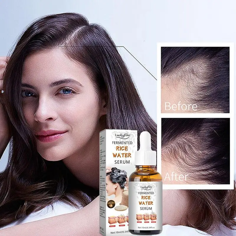 Fermented Rice Water For Hair Growth Essence Drops Thickening Hair Products To Strengthen Hair Fermented Rice Water Serum Oil