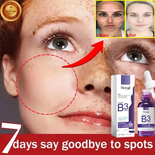 Imagen 2 del producto Hoygi-suero Facial de niacinamida, vitamina B3, pigmento para arrugas, eliminación de manchas oscuras, suero corrector brillante, crema hidratante blanqueadora Facial