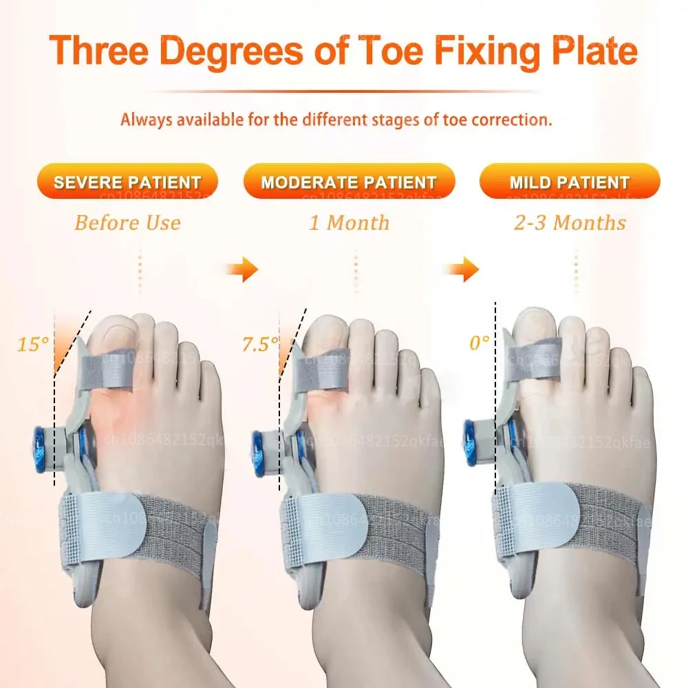 Thumbnail 4 - #2 Best Foot Care to Buy In 2026