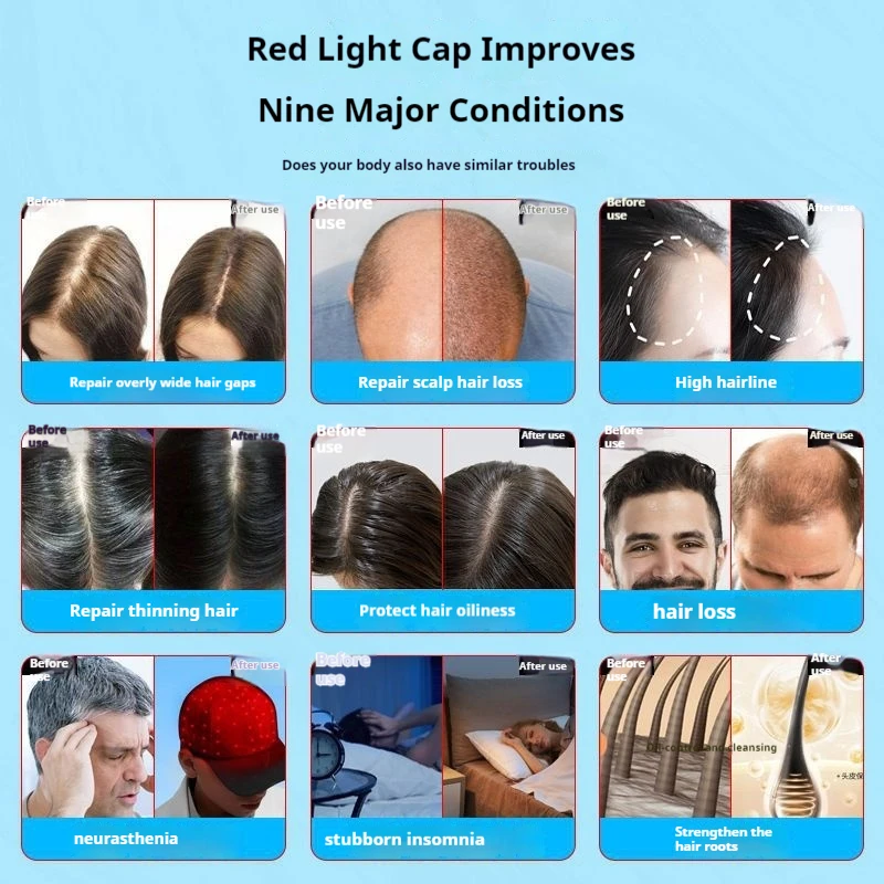 LED Infrared Red Blue Light Cap Hair Growth Loss Hair Growth Hat