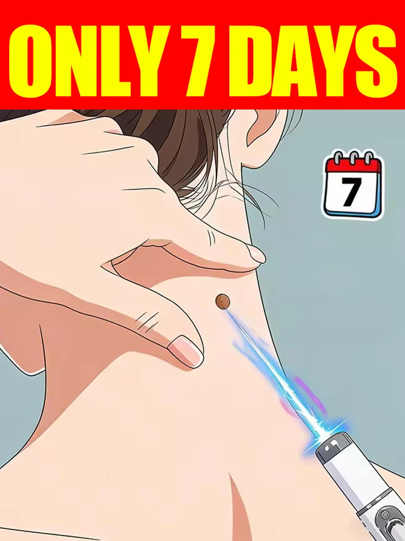 

2026NEW blue light pen to solve neck warts, wart care tools.