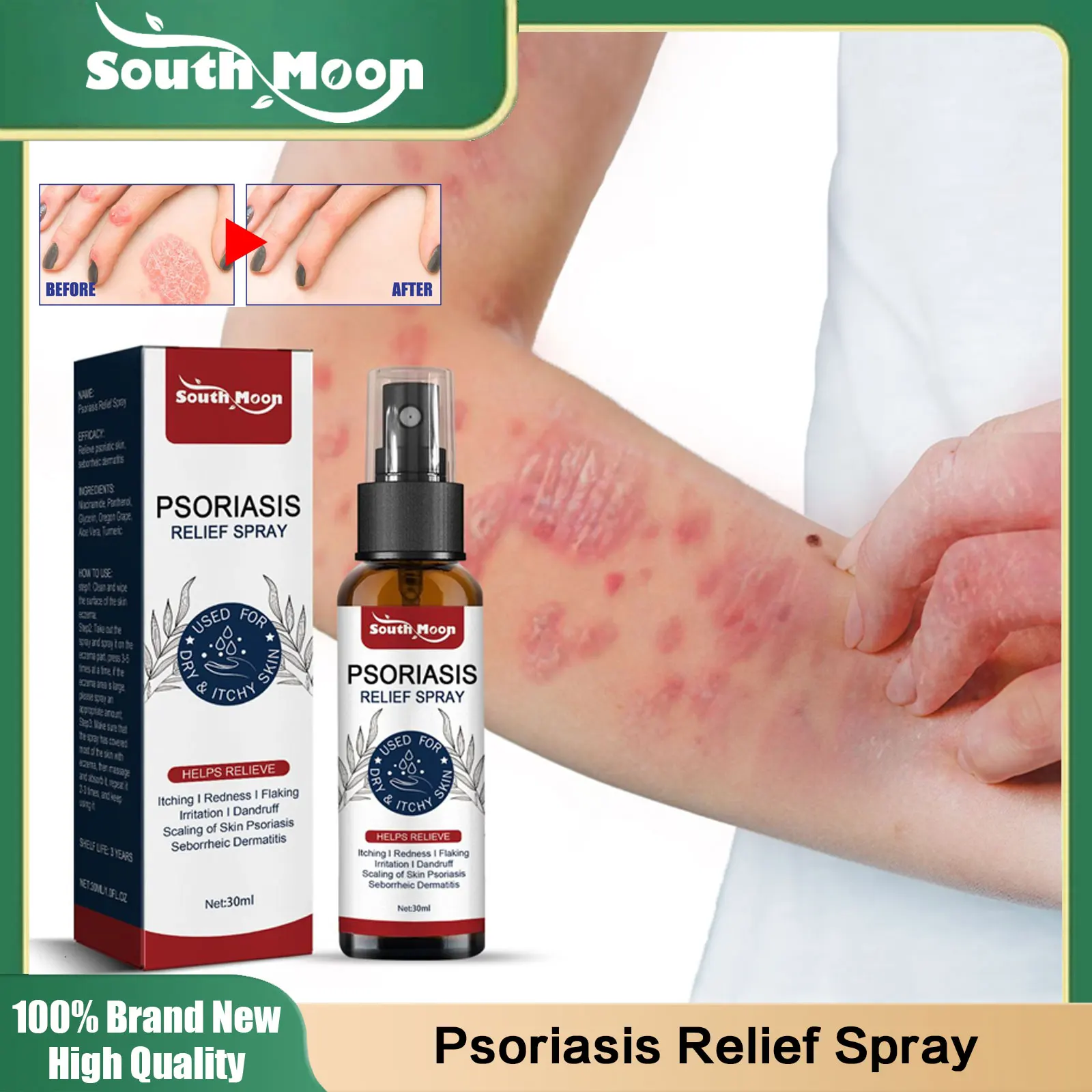 

Psoriasis Relief Spray Treatment Dermatitis Eczema Relieve Hand Foot Tinea Effective Anti-Itching Urticaria Antibacterial Spray