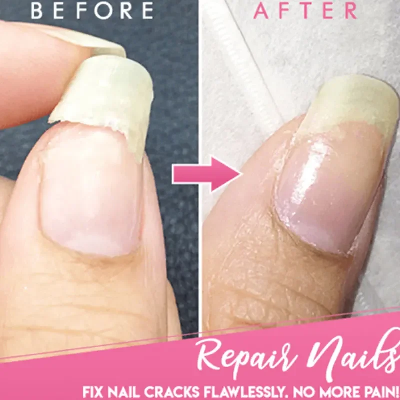 Extensão de reparo de unhas rachadas, gel para cuidados com as unhas, inofensivo para reparo de unhas quebradas, adequado para unhas em gel uv, ferramentas de manicure tslm1