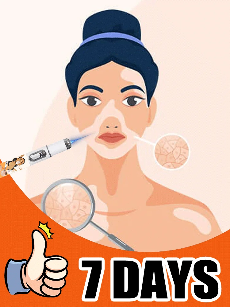 hot sale leg care tools，blue light pen solve Vitiligo