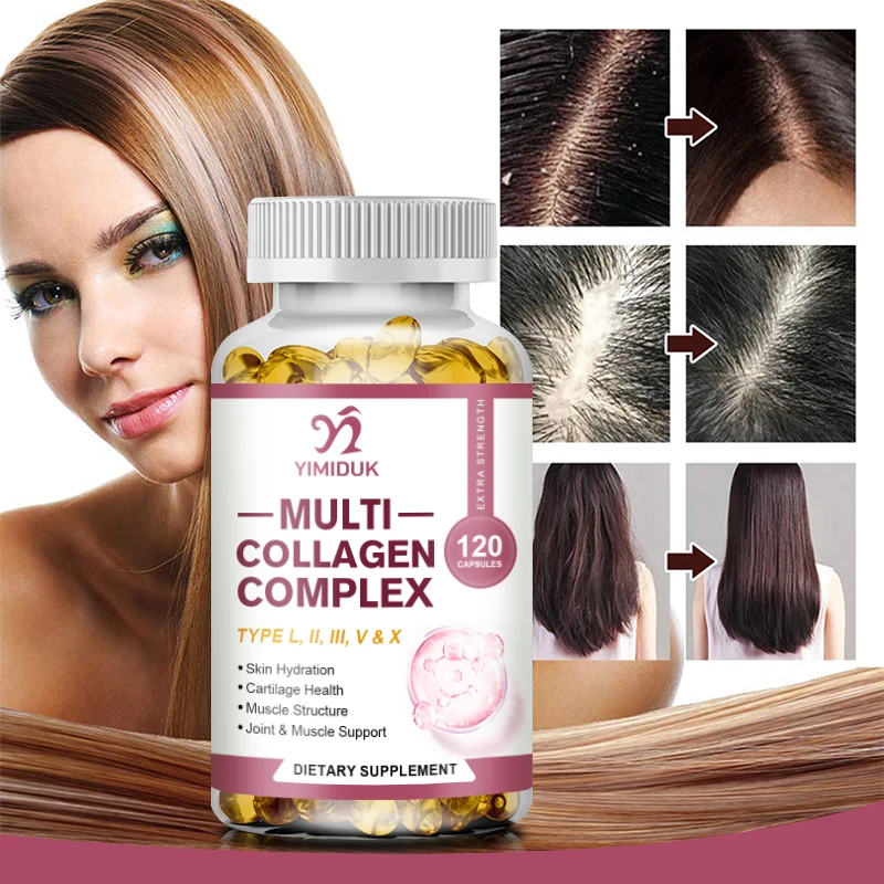 Multi-Collagen Pills with Hyaluronic Acid and Vitamin C: 5 Hydrolyzed Collagen Peptides, Type I II III VX Capsules