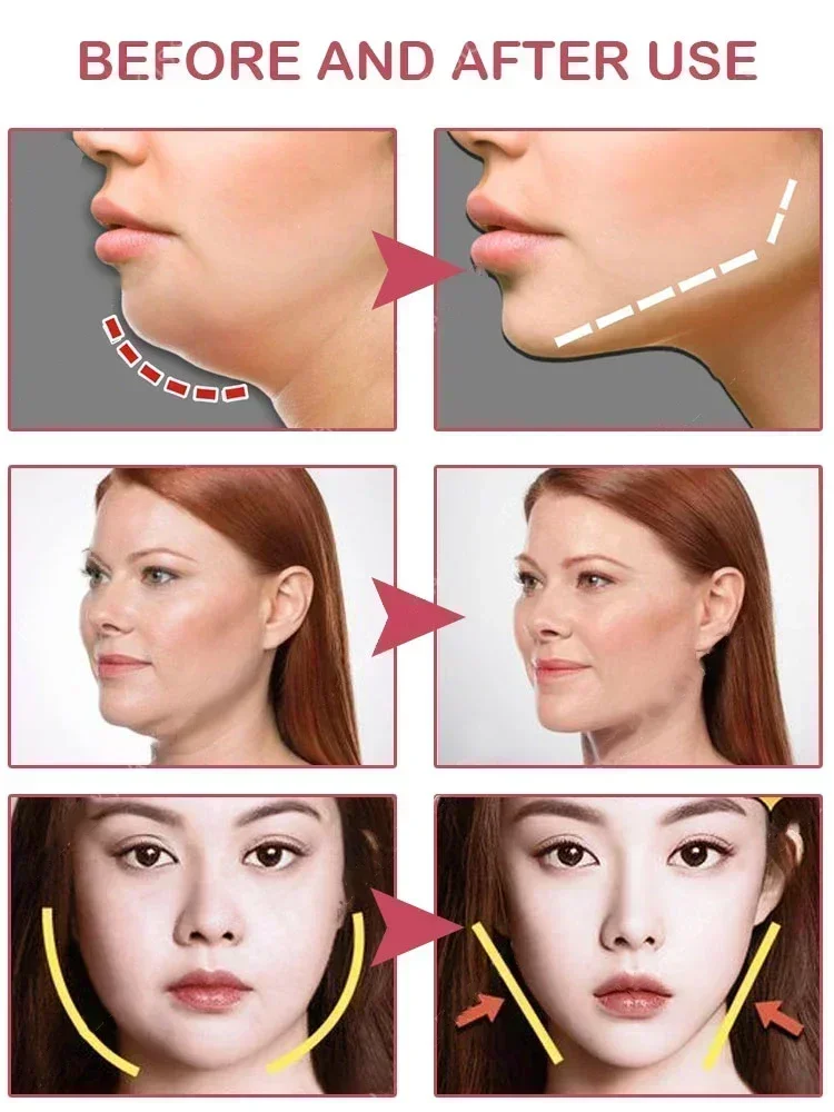 퍼밍 페이스 리프트 슬리밍 크림, V자 모양 슬리밍 제거 마사지기, 근육 이중 턱, 얼굴 지방 연소, 안티에이징 제품, 30g