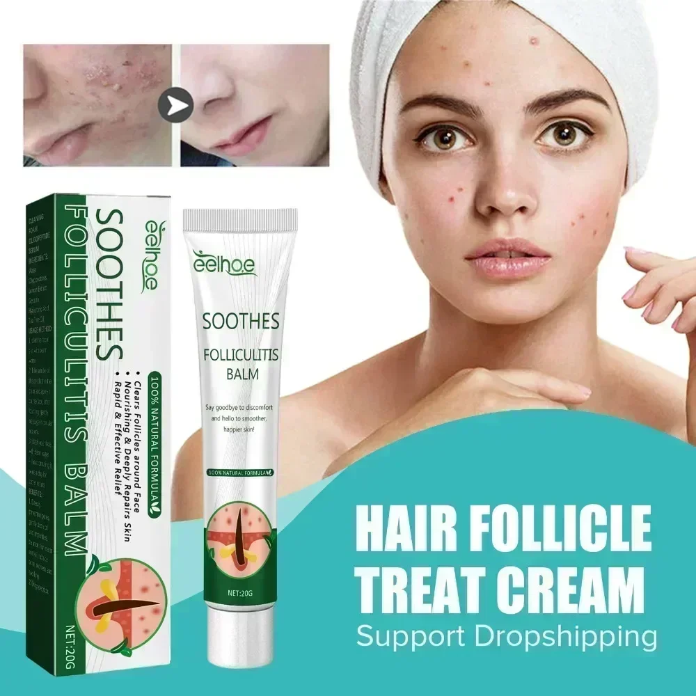 Folliculitis Psoriasis Cream Treat Inflammation Cysts Papules Acne Moisturizing Relief Dry Skin Anti Itching Antibacterial Cream