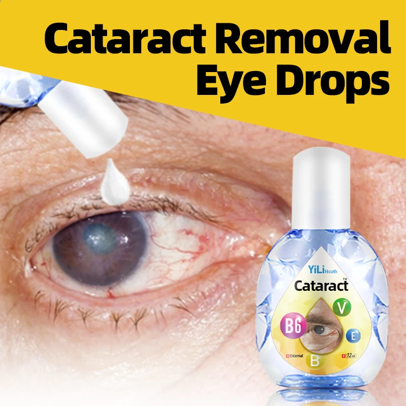 

Cataract Removal Vitamin B6 Eye Drops 12Ml Improve Blurred Vision And Eye Discomfort Glaucoma Presbyopia Treatment Eyes Drop