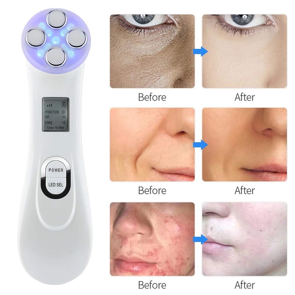 RF EMS Facial Massager Microcurrent Color Light Beauty Device Skin Rejuvenation IPL Lift Firming Anti-aging Face Lifting Tool