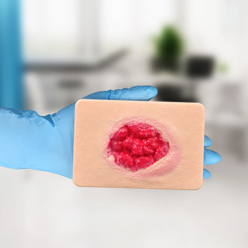 Hypergranulation Tissue Model for Wound Care Training and Research