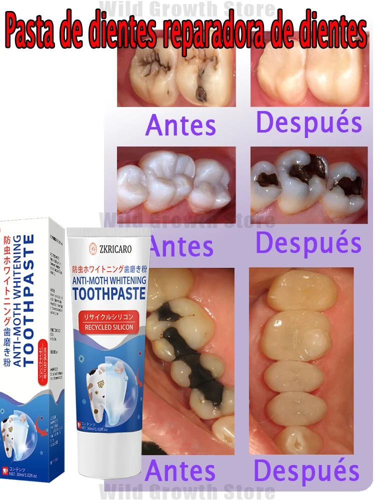 Reparación de silicona regenerativa científica, eliminación de cavidades, superventas