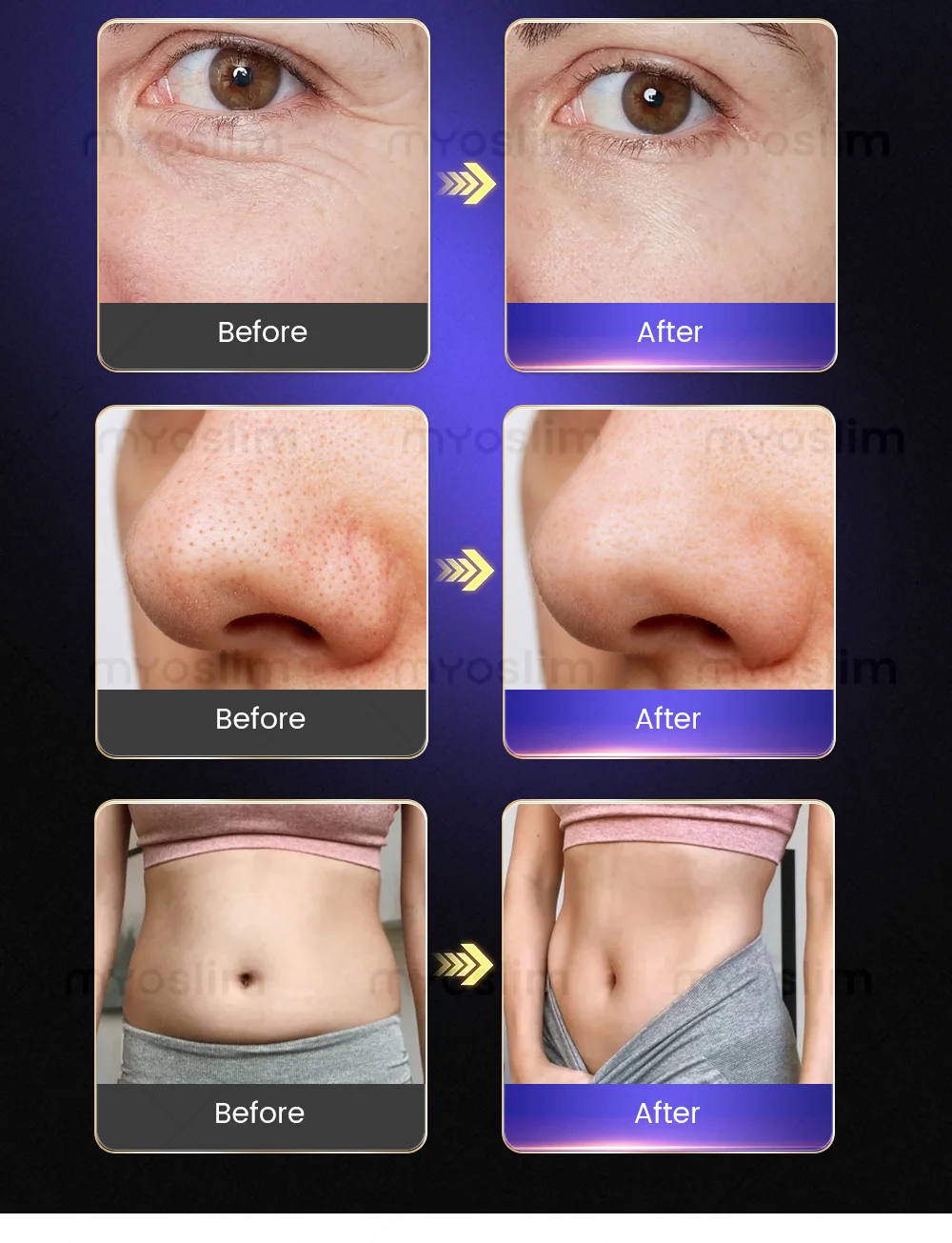 

Новейший AI-анализатор лица, профессиональный косметический анализ лица, тестер для лица, красоты, 3D-сканер кожи для лица