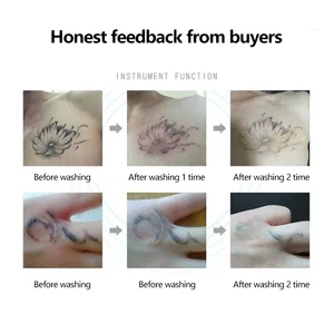 8ベストセールスモールリムーバー-11