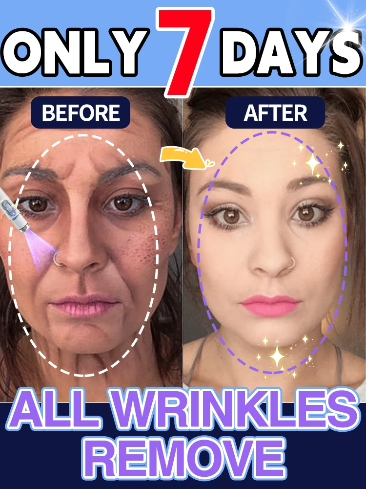 

Instant Wrinkle Remover Fade Fine Lines Face Cream Anti Aging Firming Lifting Whitening Moisturizing Brighten Tighten Skin Care