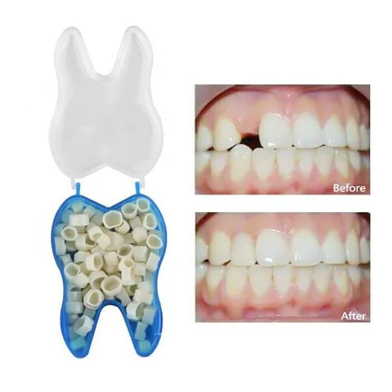 50/100pcs Resin Teeth Set Dental Temporary Crown Kit Teeth Whitening Veneers Materials Tooth Cosmetic Restoration Supplies