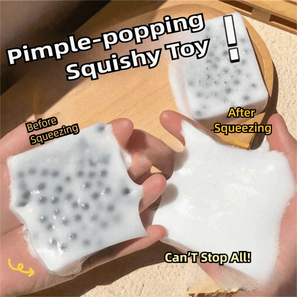 ของเล่นบีบสกุชชี่ บีบสิว บรรเทาความวิตกกังวล ใช้ซ้ำได้ ของเล่นบีบสกุชชี่ ของเล่นบีบสกุชชี่ ดีไซน์สัมผัส