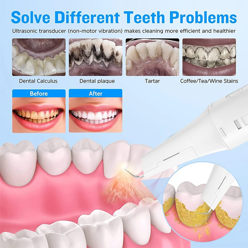 T13 pro visível removedor de cálculo doméstico ultra sônico limpador de dentes sem fio app eletrônico sonic limpador de dentes raspador dental